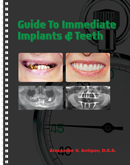 Guide to Immediate Implants and Teeth paperback