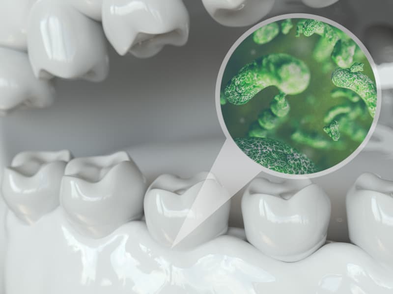Understanding dental implant complications and risks