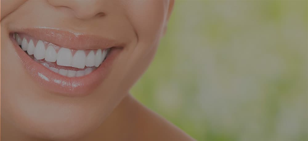 Dental implant patient results — same-day teeth, full arch restoration — Dr. Antipov, Roseville CA — Photo 3