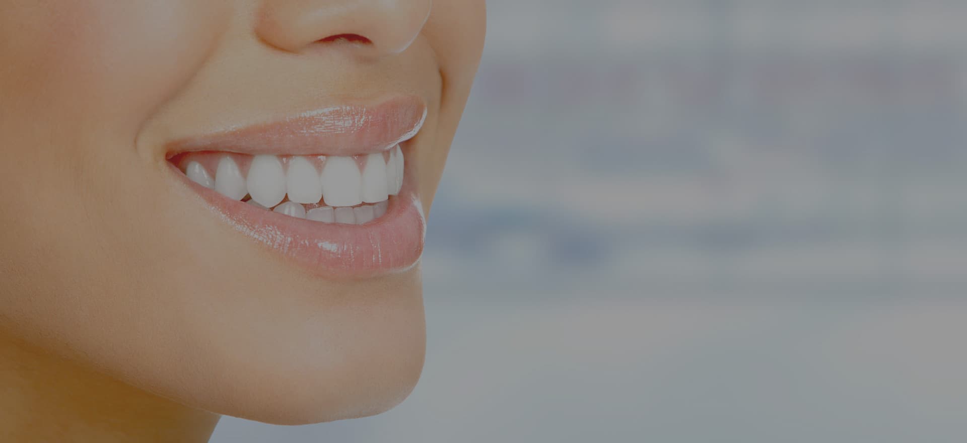 Dental implant patient results — same-day teeth, full arch restoration — Dr. Antipov, Roseville CA — Photo 1