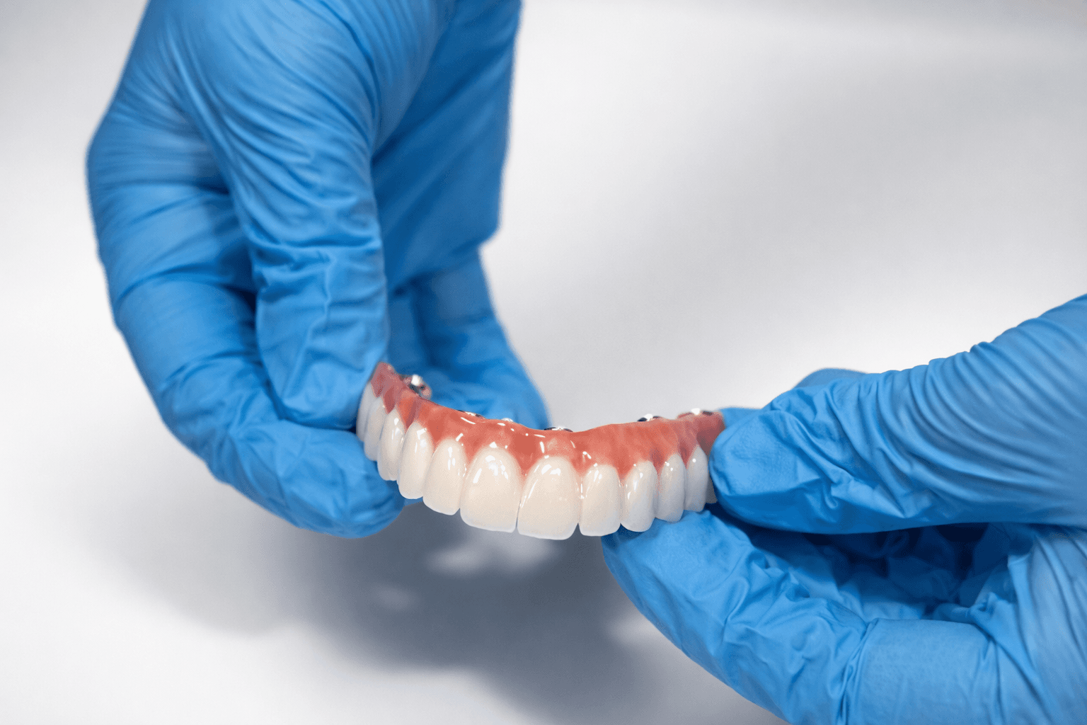 Full Arch Dental Implants — All-on-4, All-on-6, Zygomatic & Teeth-in-a-Day — Dr. Alexander Antipov, Oral Surgeon, Roseville CA