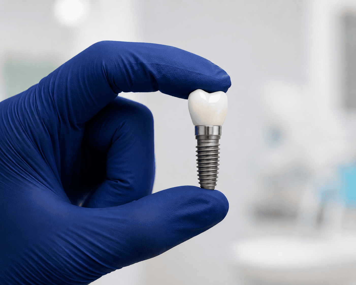 Single & Multiple Tooth Implants — Individual Implants, Bridges & Implant-Supported Dentures — Dr. Alexander Antipov, Oral Surgeon, Roseville CA