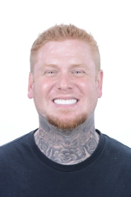 Male patient smiling after dental implant treatment