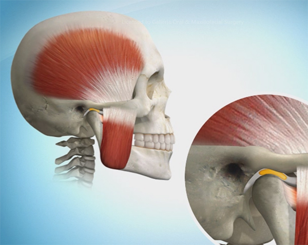 Sacramento Study Club — Complex Restorative & TMJ