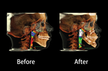 Counterclockwise face rotation surgical solution ct-scan before after view