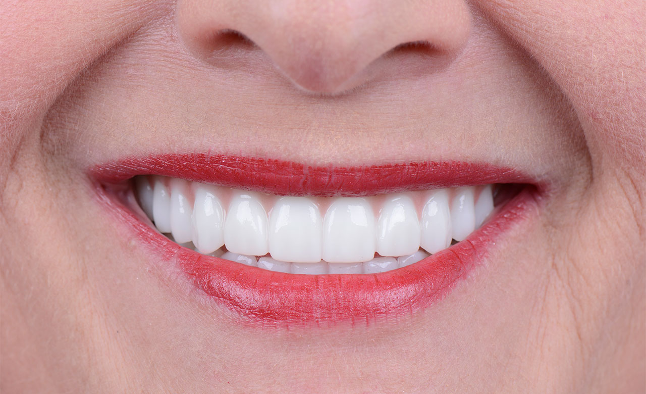 video testimony abot orthognathic surgery results